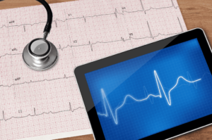 Elettrocardiogramma: quando e dove fare l’ECG